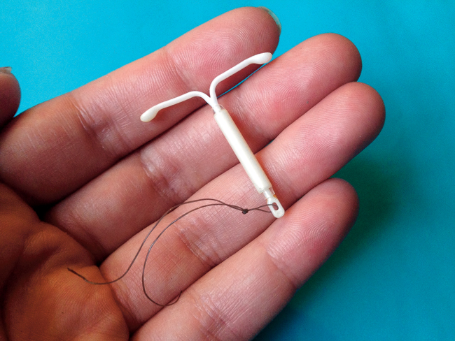 The Mirena intrauterine device (IUD) is one of many forms of long-lasting birth control Student Health Services offers to students at UND.